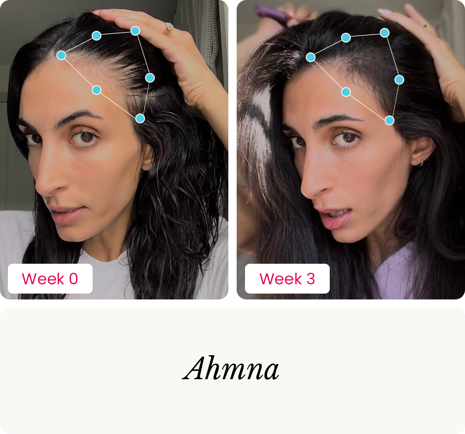 Ahmna before and after photos for MBPC