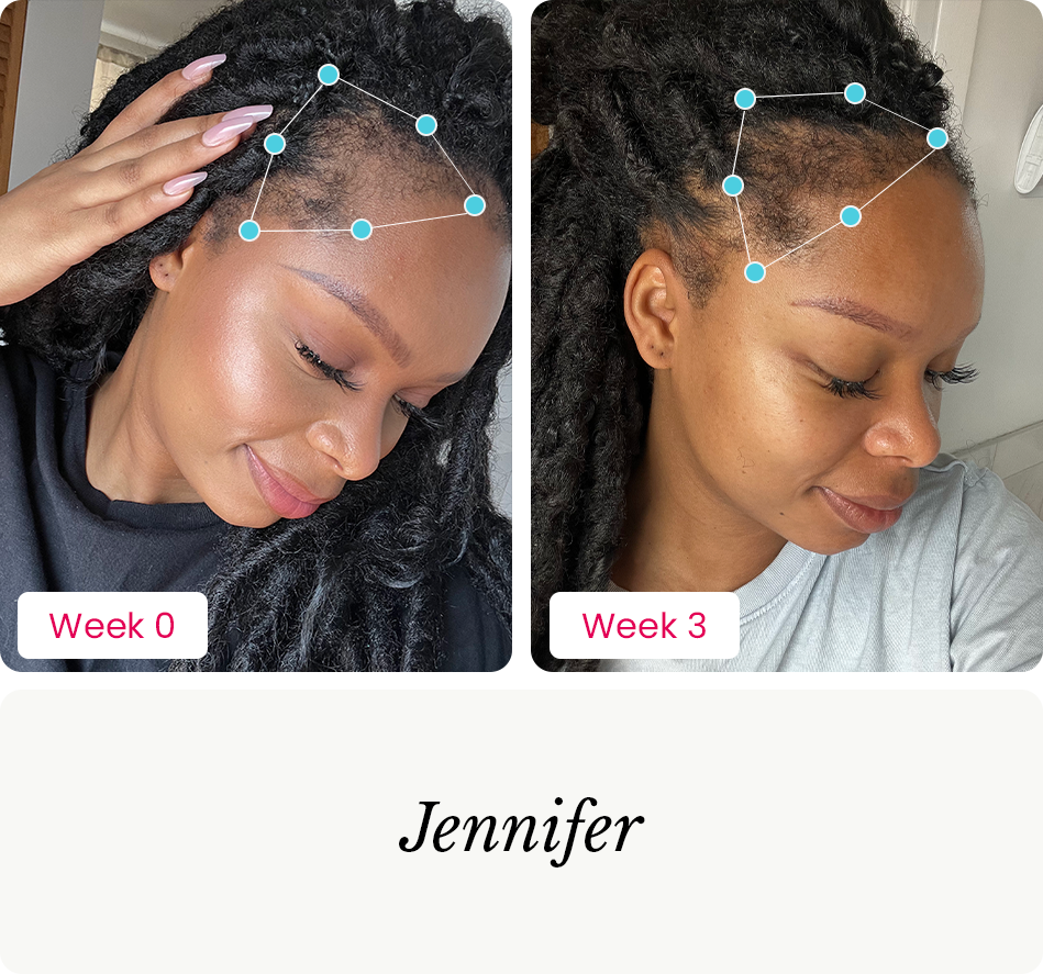 Jennifer before and after photos for MBPC